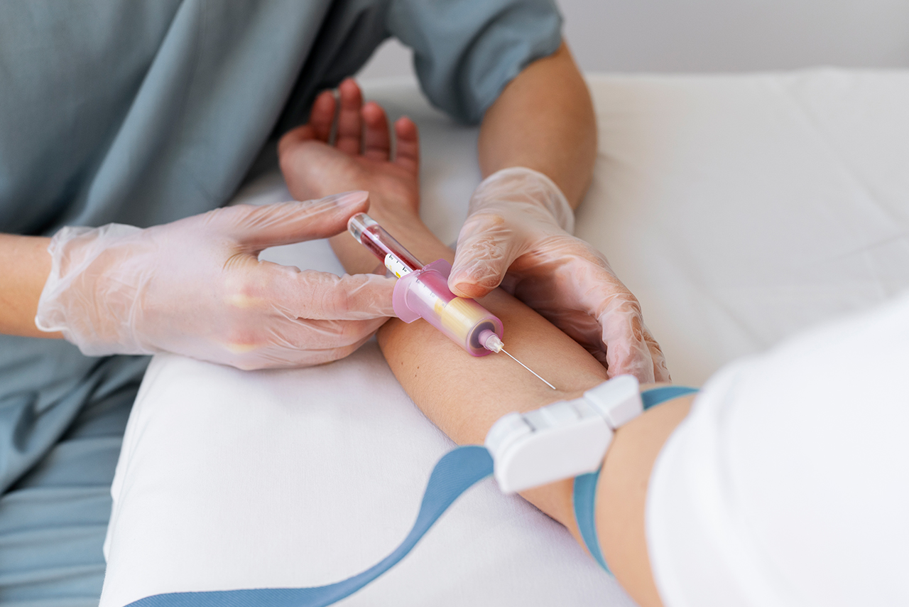 Best GFC Treatment in Kochi