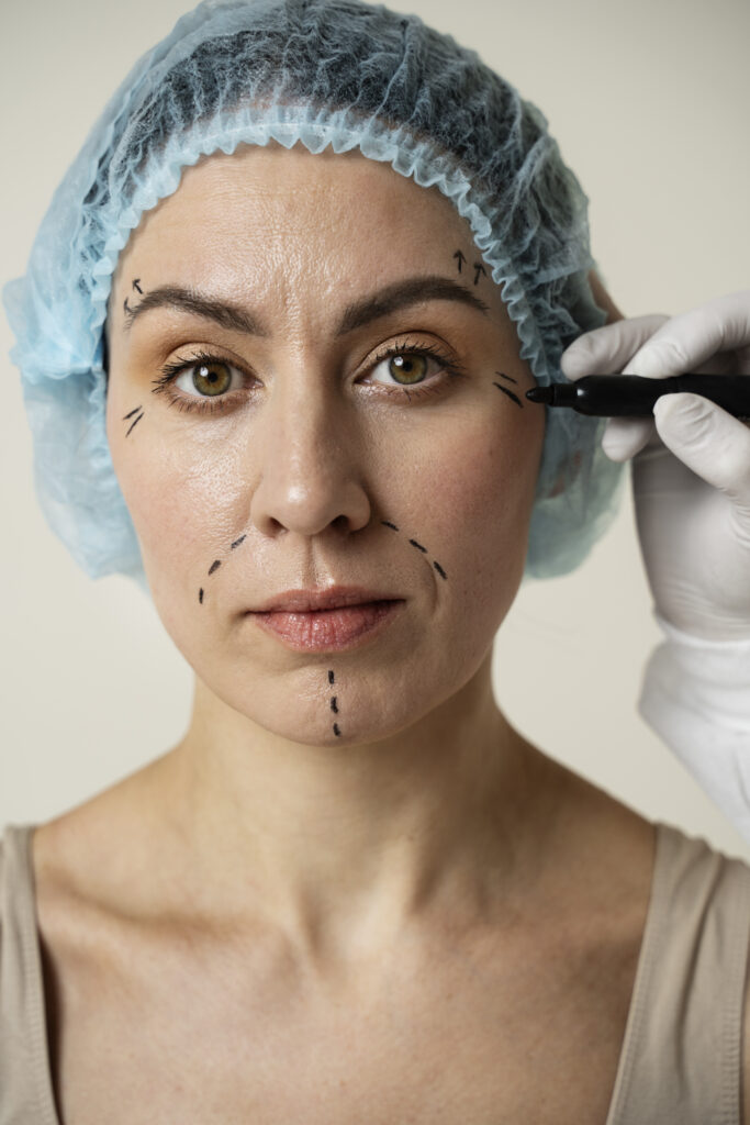 Best Thread Lift Treatment in Kochi