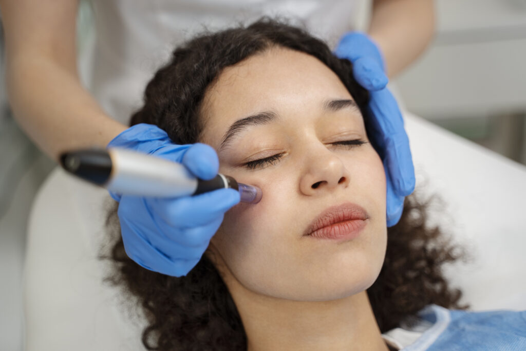 Micro-needling treatment in kochi