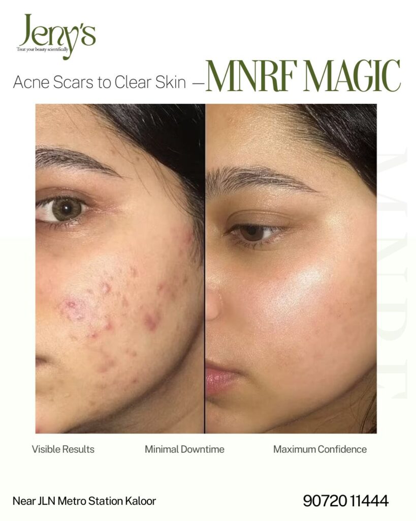 Best Skin Clinic in Kochi