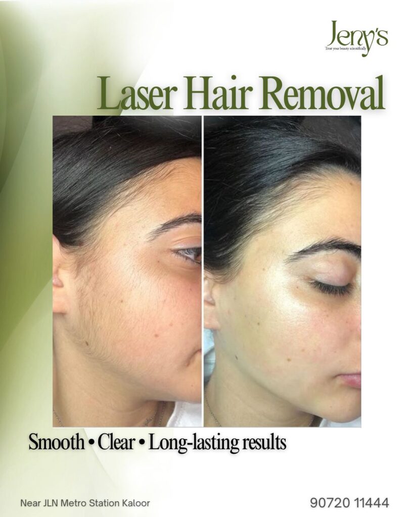 Skin treatment result at aesthetic clinic in Kochi